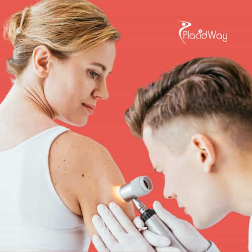 What Immunotherapy Options Exist for Melanoma in Mexico?